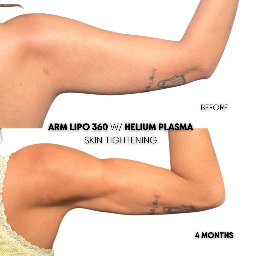 $899 per area - !. → (2) 28