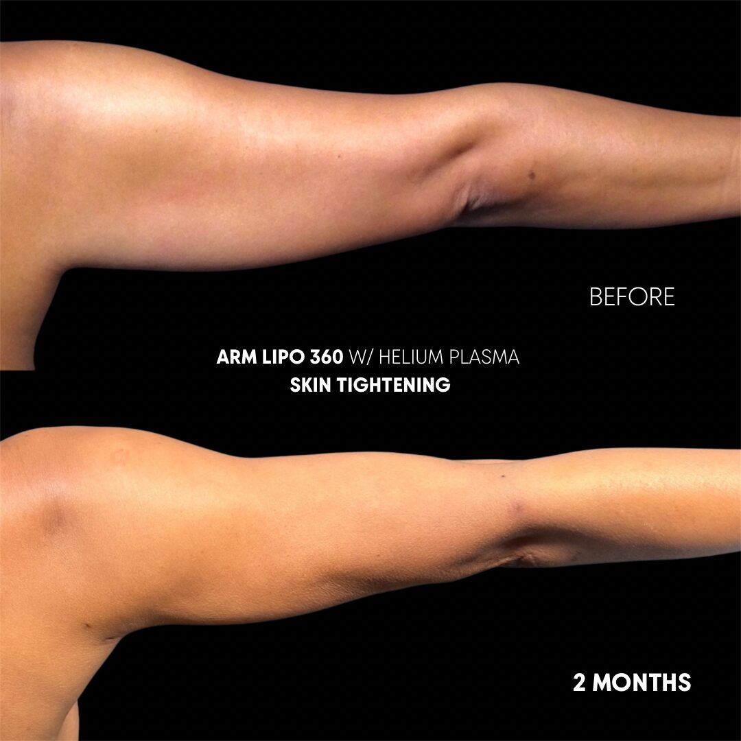 $899 per area - !. → (2) 29