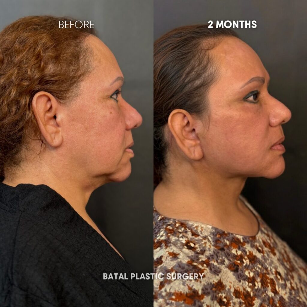 $899 per area - !. → (2) 30