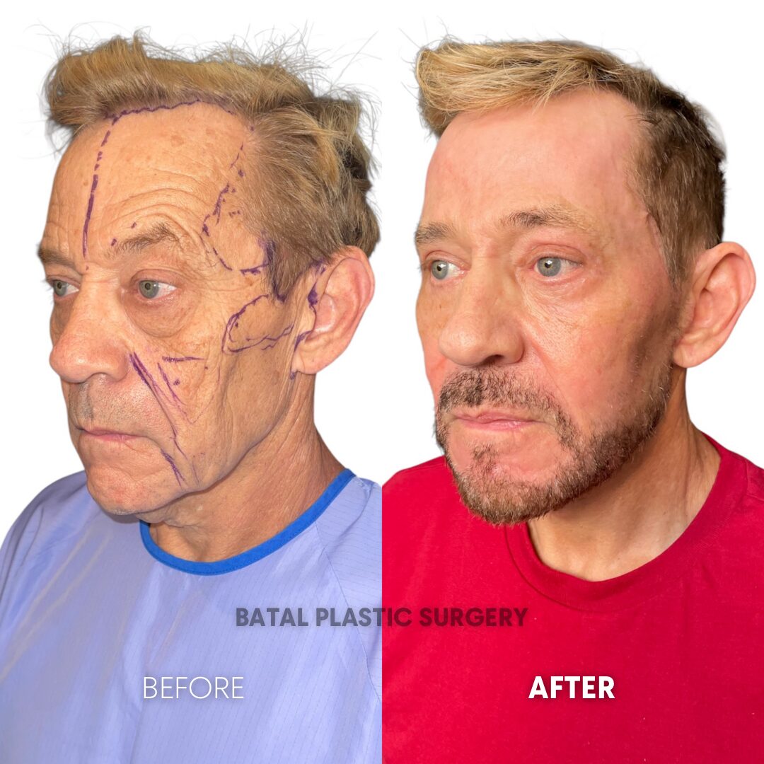 $899 per area - !. → (2) 32