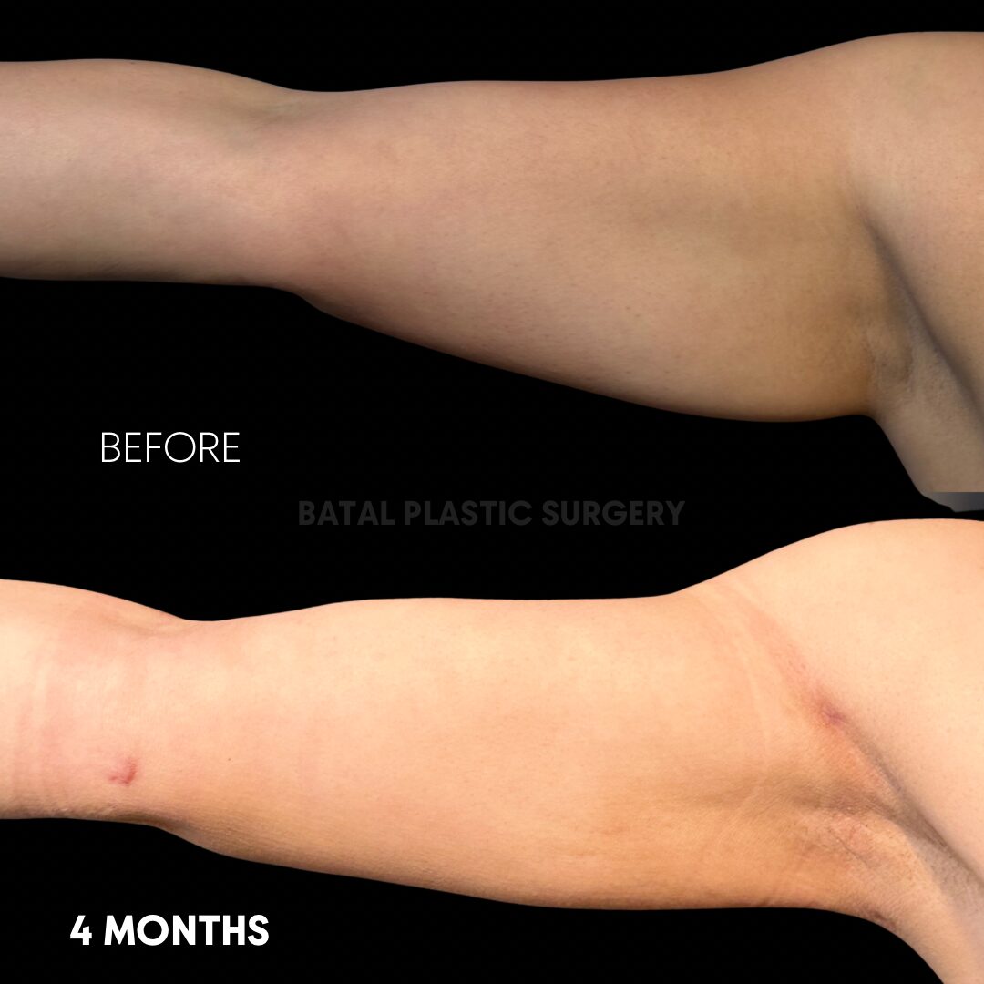 $899 per area - !. → 23