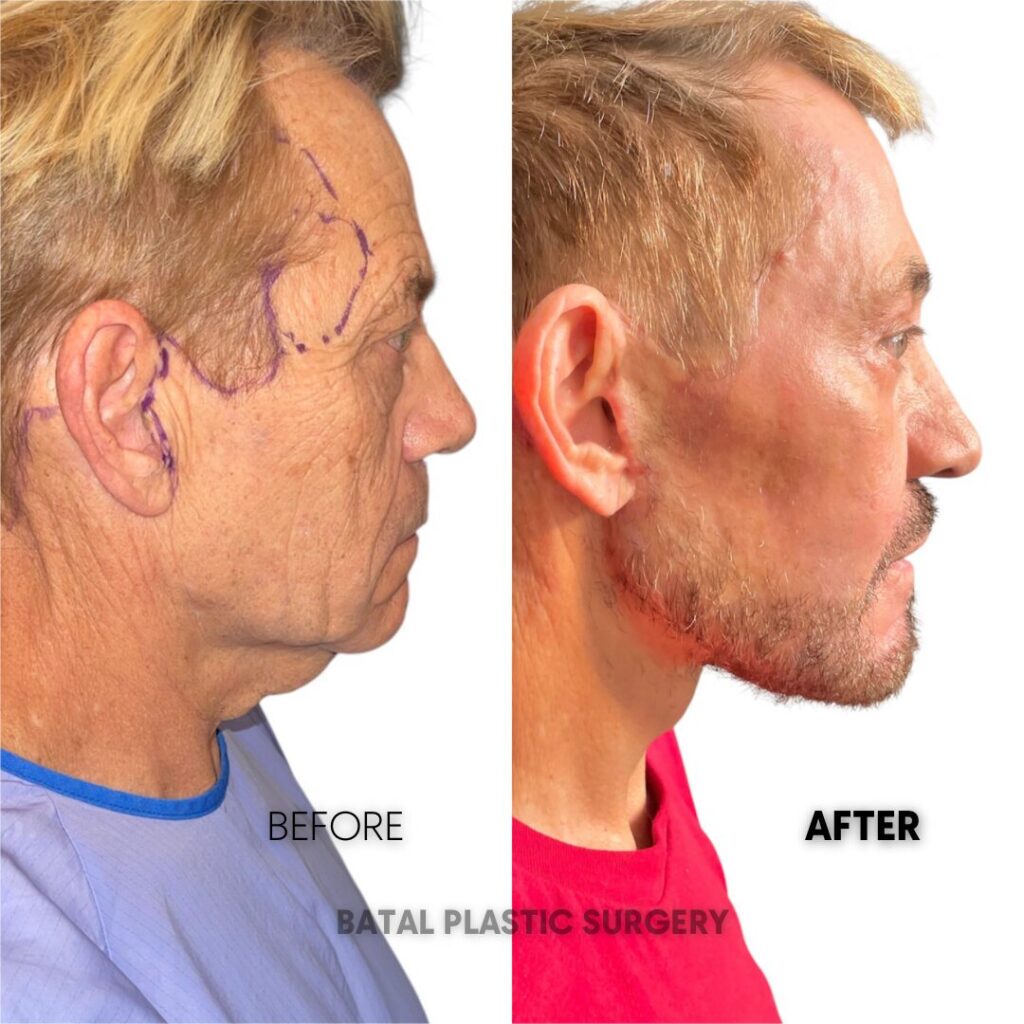 $899 per area - !. → (3) 23