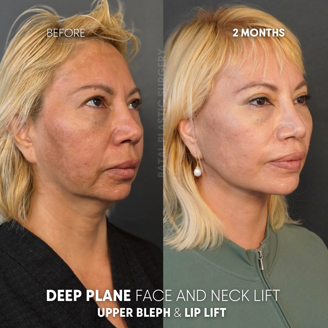 $899 per area - !. → (3) 6