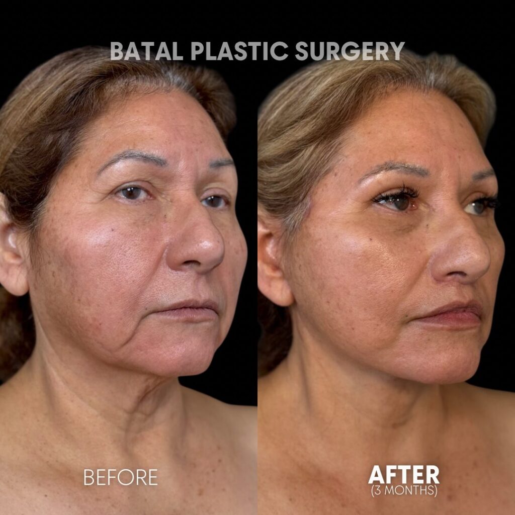 $899 per area - !. → (3) 7