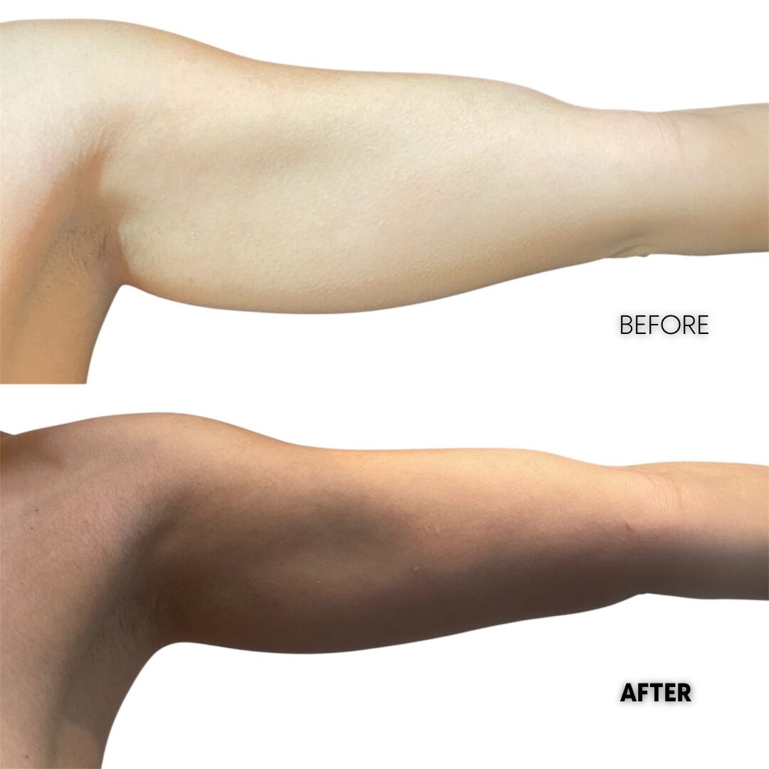 $899 per area - !. → (4) 9