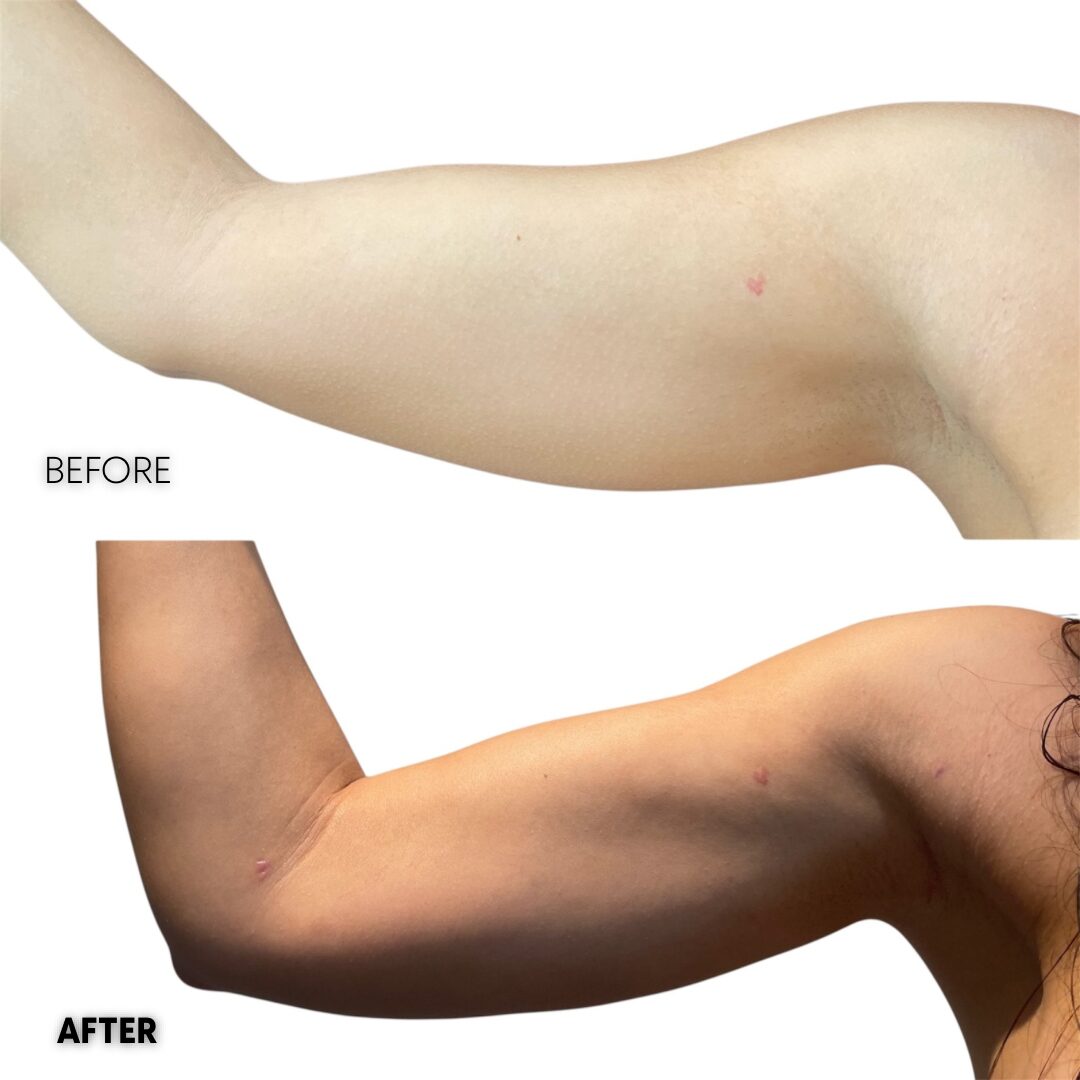 $899 per area - !. → (5) 5