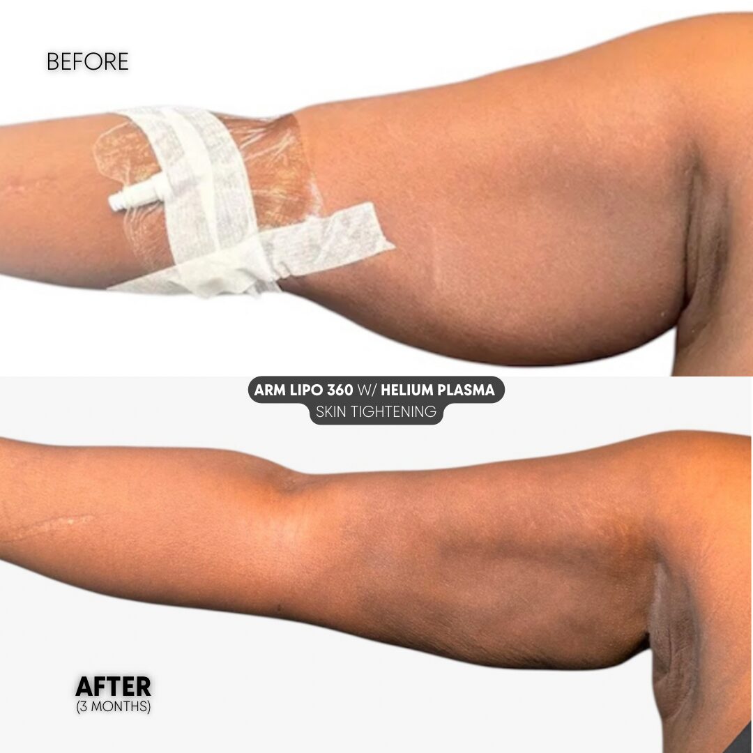 $899 per area - !. → (5) 6