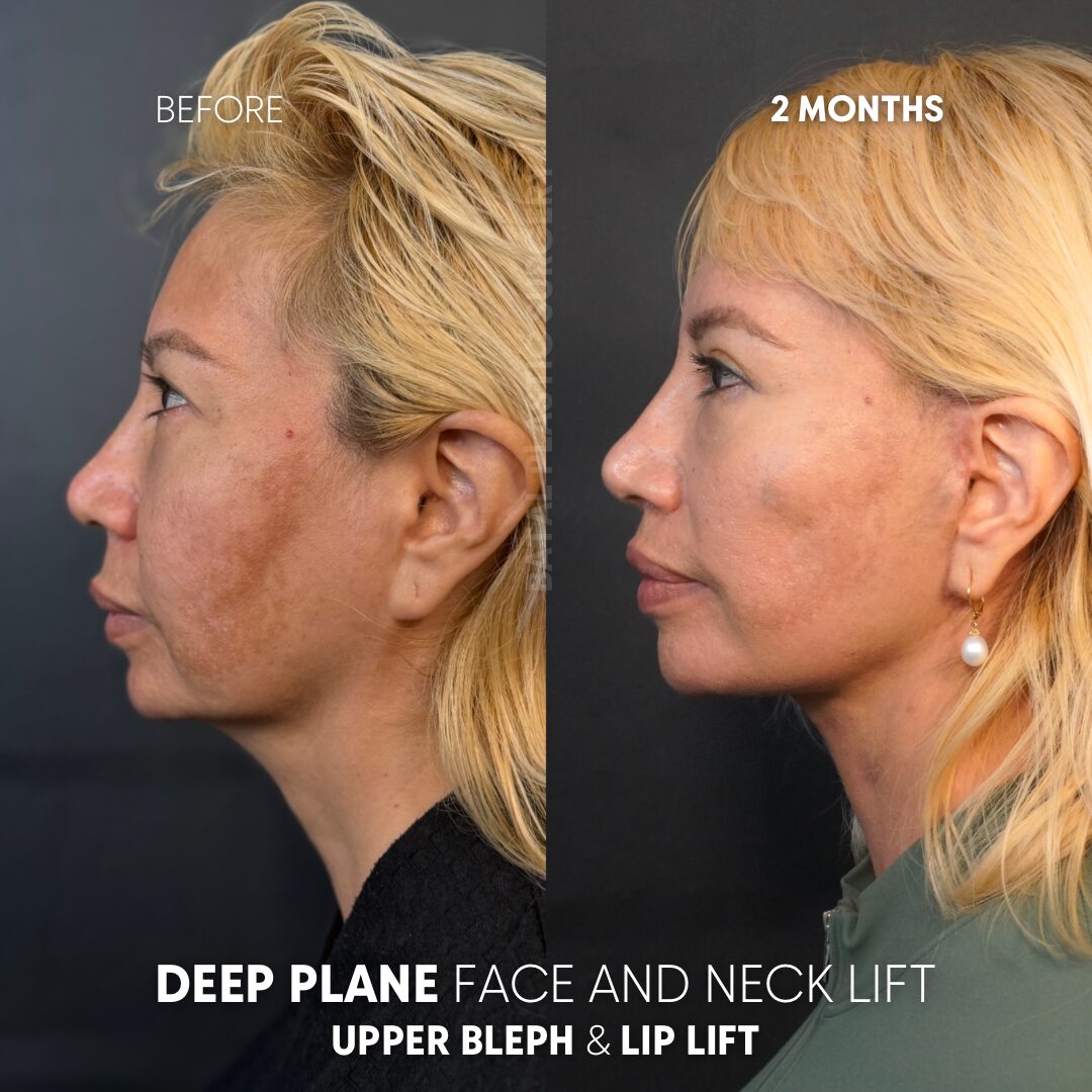 $899 per area - !. → 9