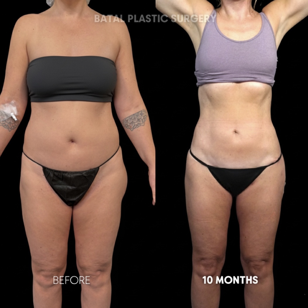 $899 per area - !. → (3)