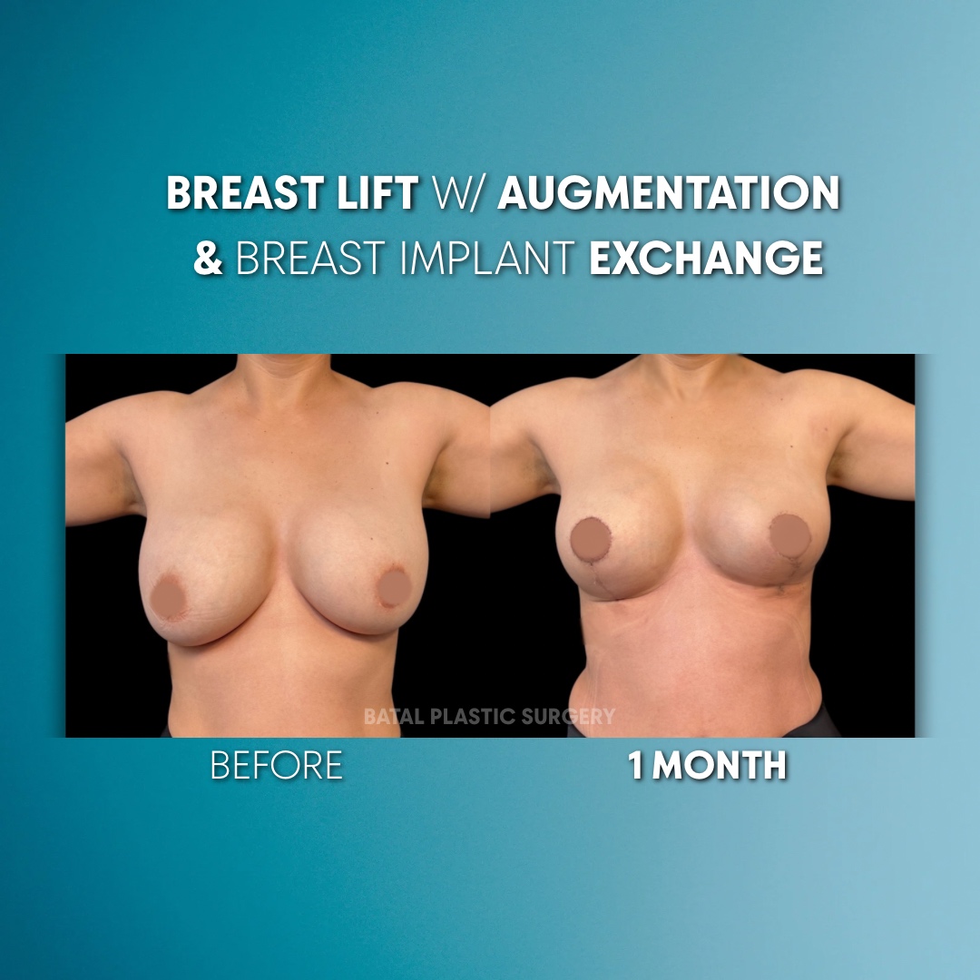 B67BFDEB-E157-41B1-A586-AA9AE120916B