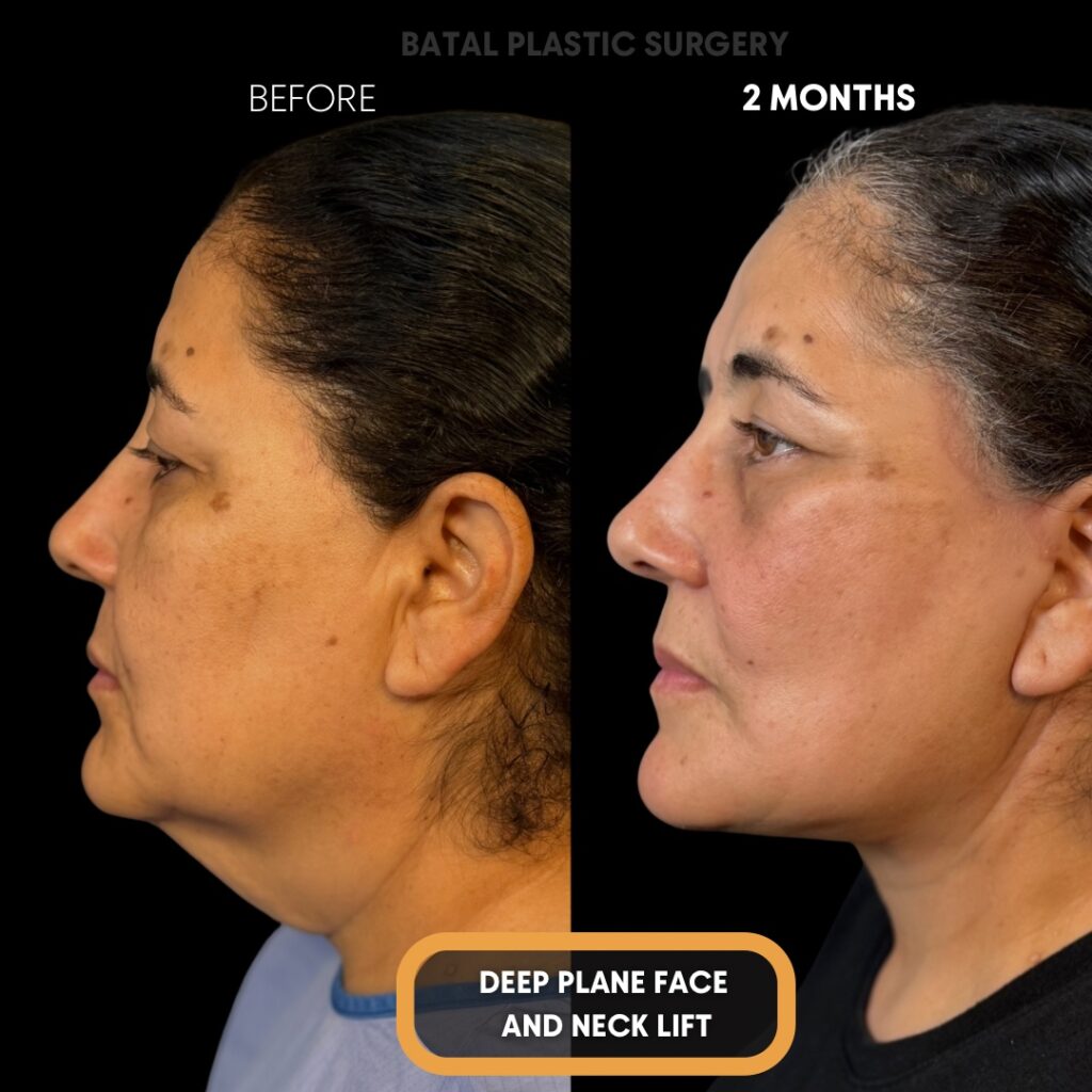 CA471A08-820B-4928-9FBA-9DF6DECE39EB