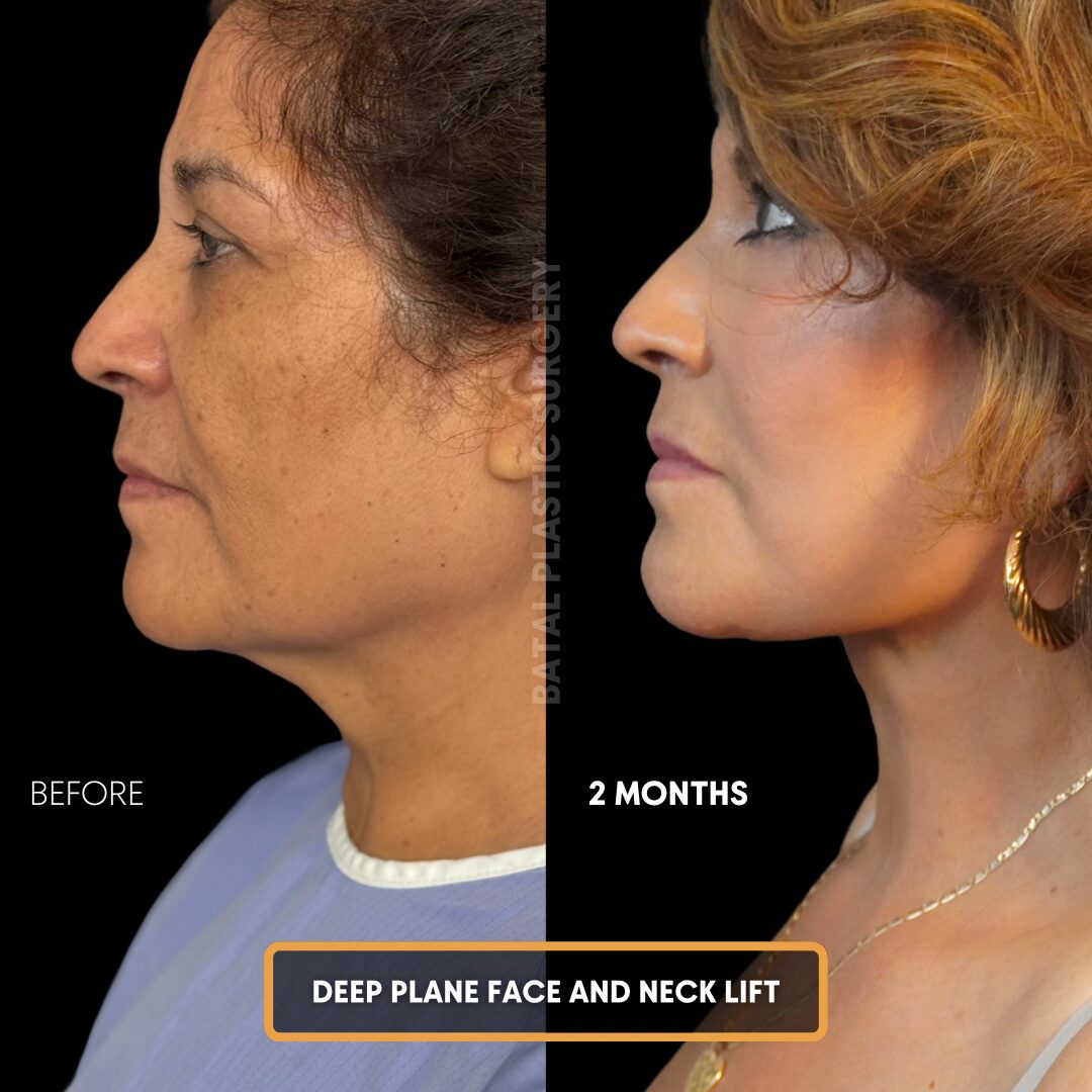 Copy of $899 per area - !. → (2)