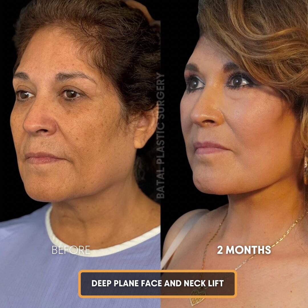 Copy of $899 per area - !. → (4)