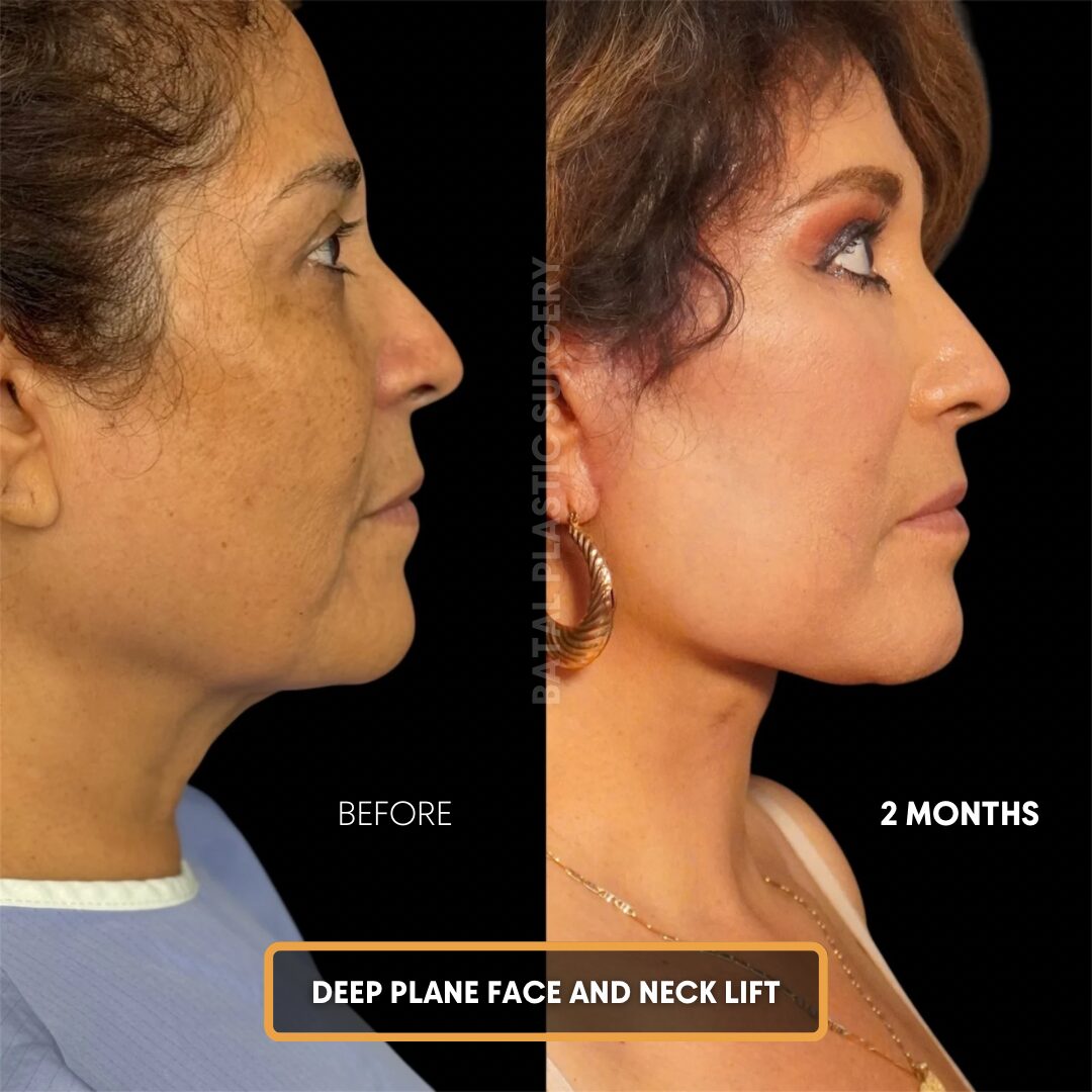 Copy of $899 per area - !. →