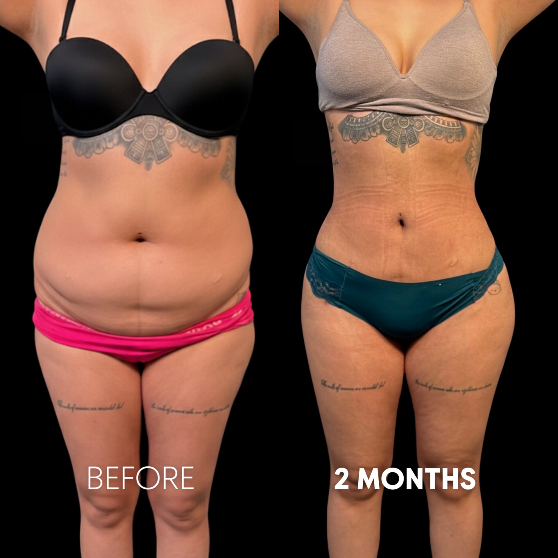 D987CD25-5F13-4C9C-BEF5-F29880DAE798