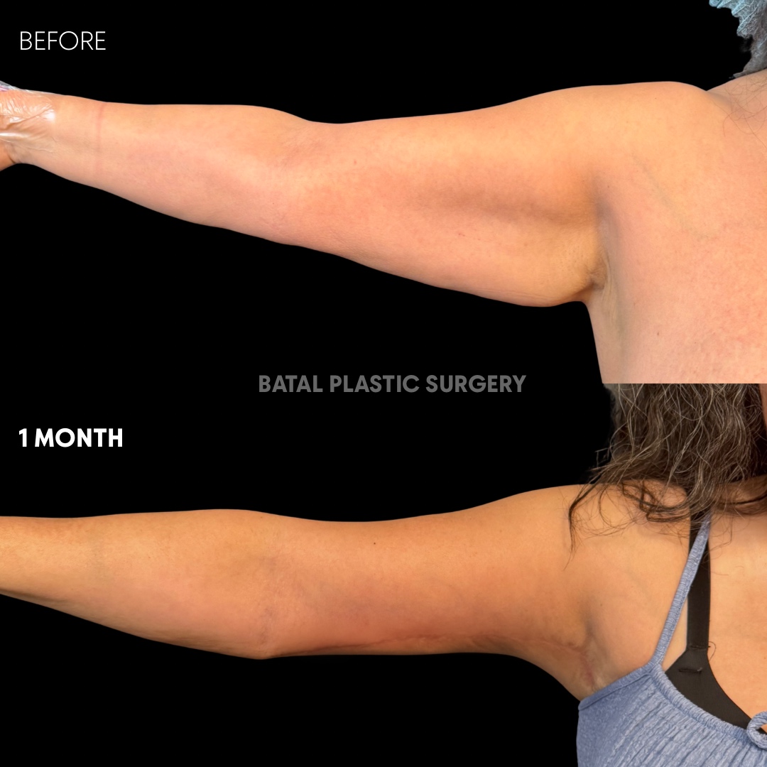 E3DBF829-2377-4726-BB9F-56DDDECB7D58